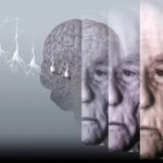طراحی ابزار هوش مصنوعی برای تشخیص نوع و شدت زوال عقل